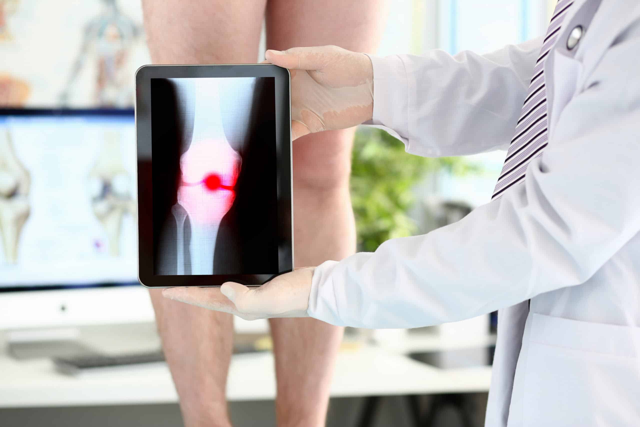 A doctor examines a patient’s chronic pain symptoms with the help of a reliable pain management EHR.